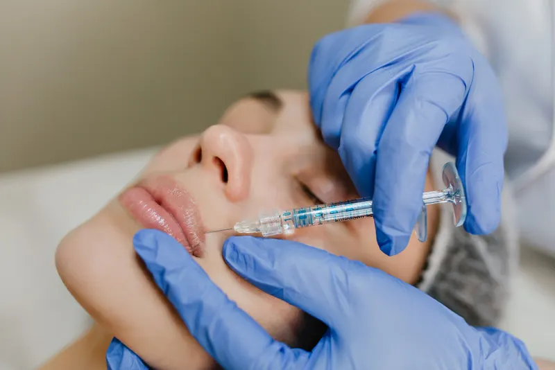 Dermal filler treatment